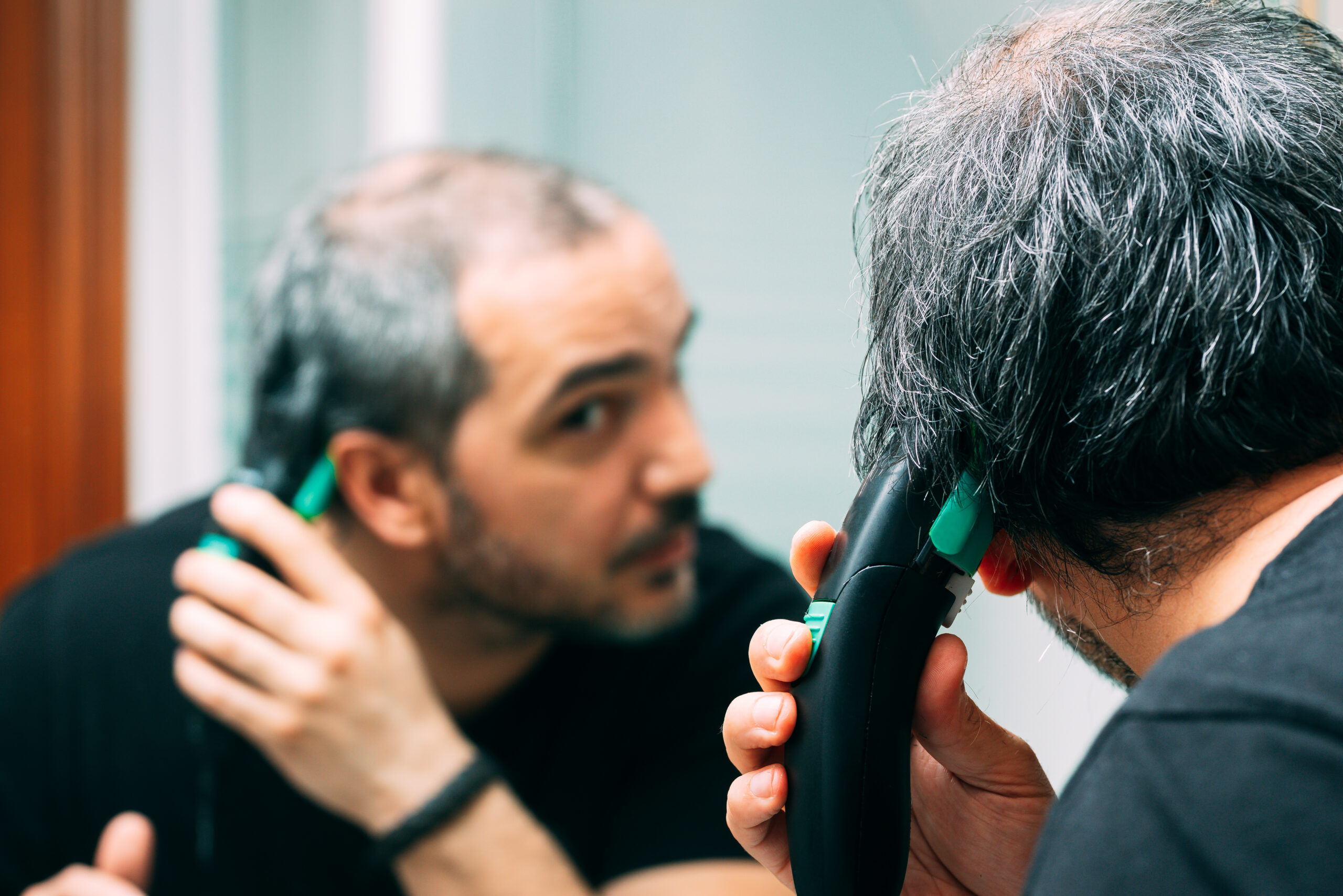 Os Principais Mitos e Verdades Sobre o Implante de Cabelo