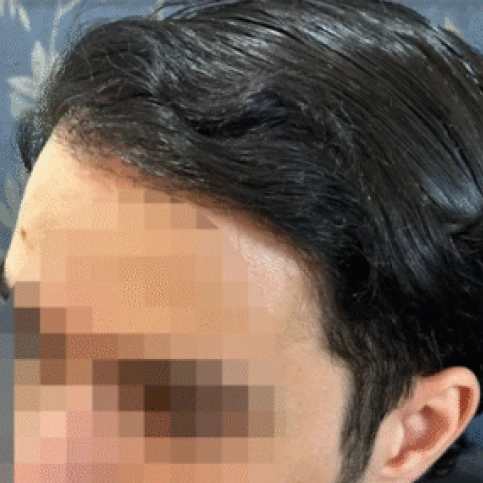 06 - 02